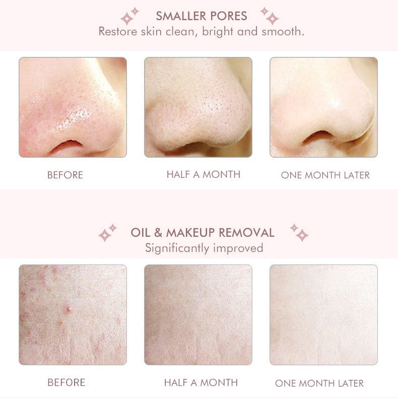 Skin Scrubber │ Say Goodbye to Clogged Pores