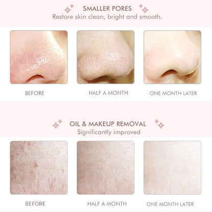 Skin Scrubber │ Say Goodbye to Clogged Pores