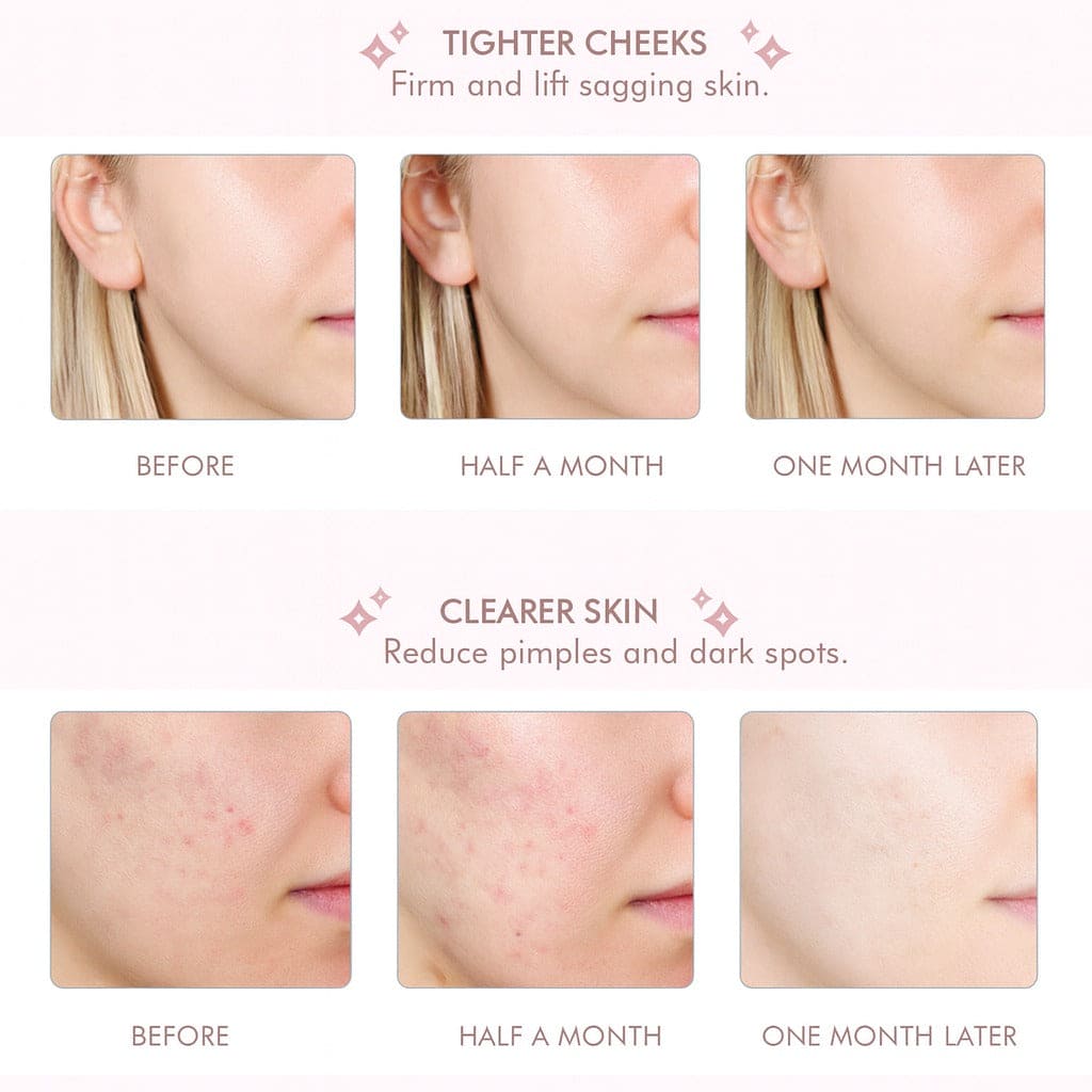 Skin Scrubber │ Say Goodbye to Clogged Pores