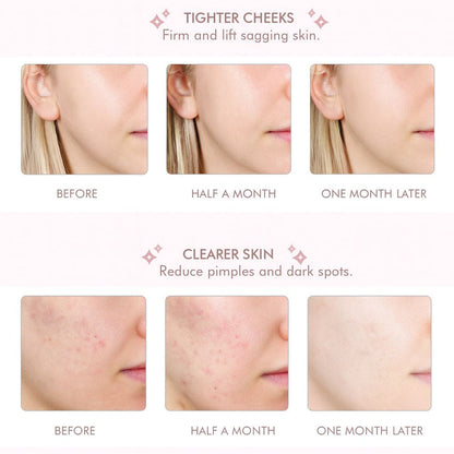Skin Scrubber │ Say Goodbye to Clogged Pores