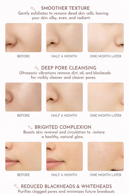 Skin Scrubber │ Say Goodbye to Clogged Pores